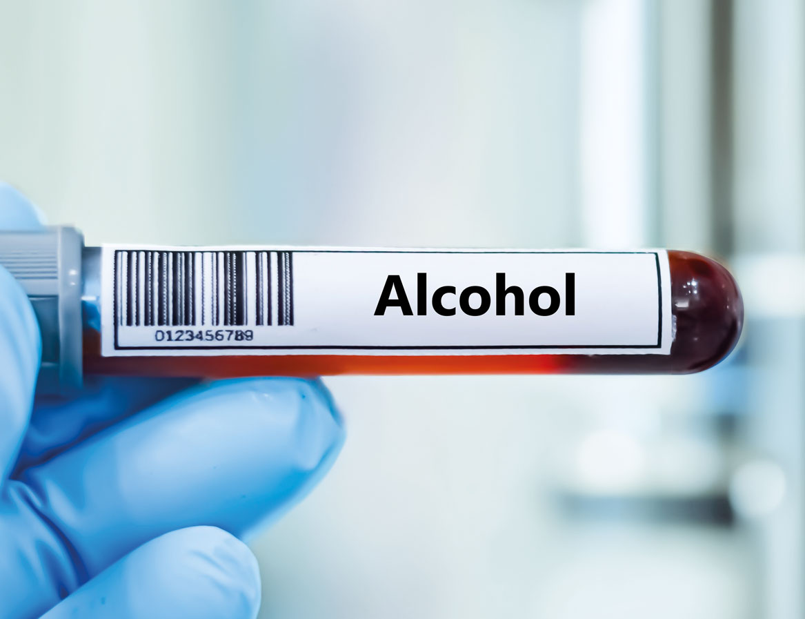 Drogenanalytik im Urin - Chromsystems Drogenanalytik im Urin - Analytica