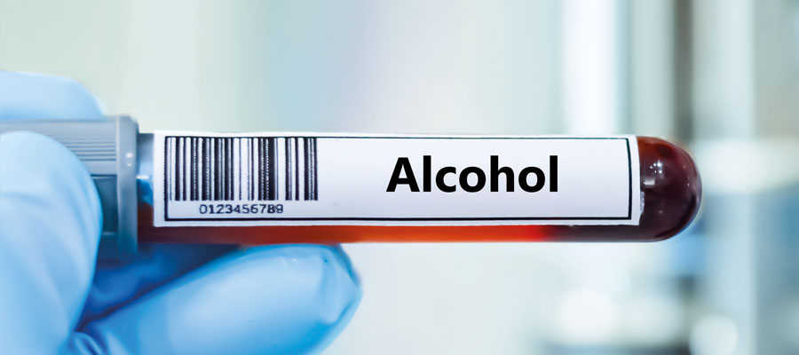 App Note of Immunosuppressants with Series A