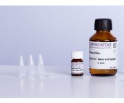 MassChrom® Amino Acid Analysis Urine Set