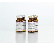 0376 0377 LCMS Total Metanephrines Urine Controls