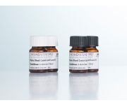 0077 0078 0079 HPLC glutathione whole blood controls
