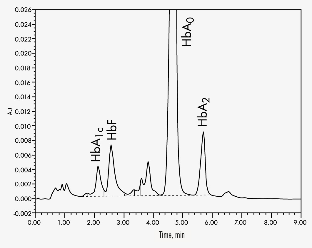 تحليل hemoglobin Hemoglobin