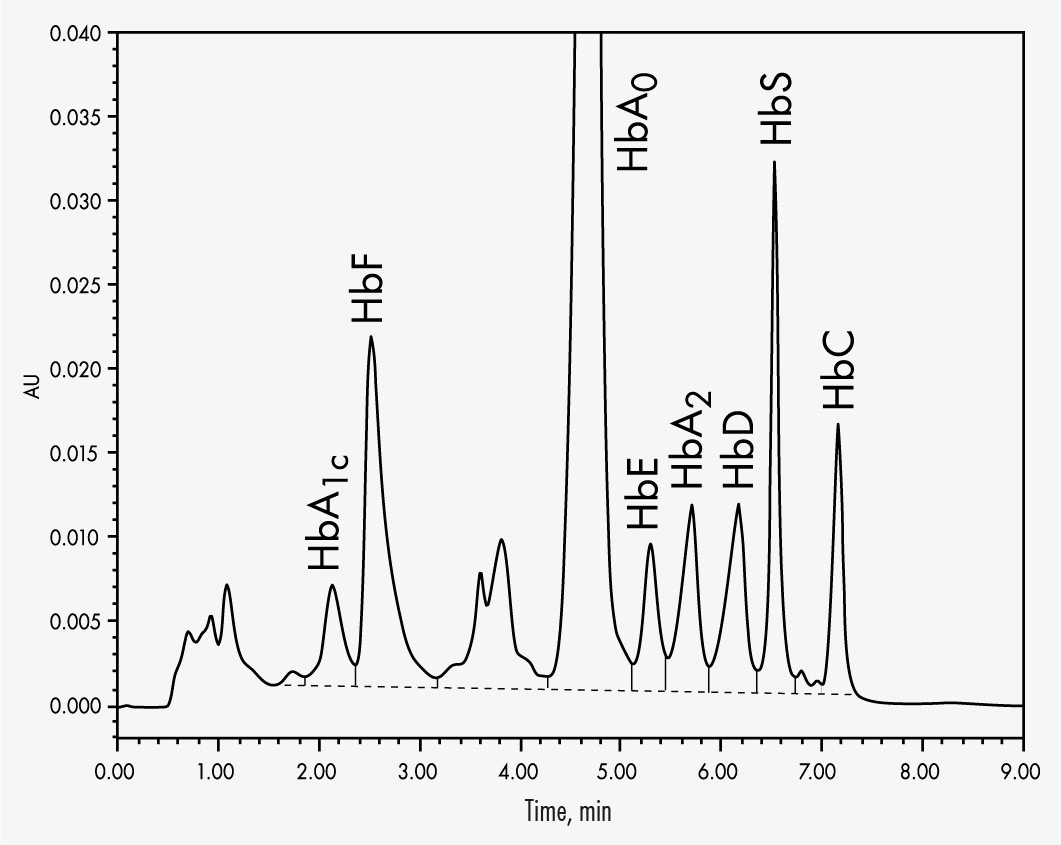 متغيرات الهيموغلوبين HPLC